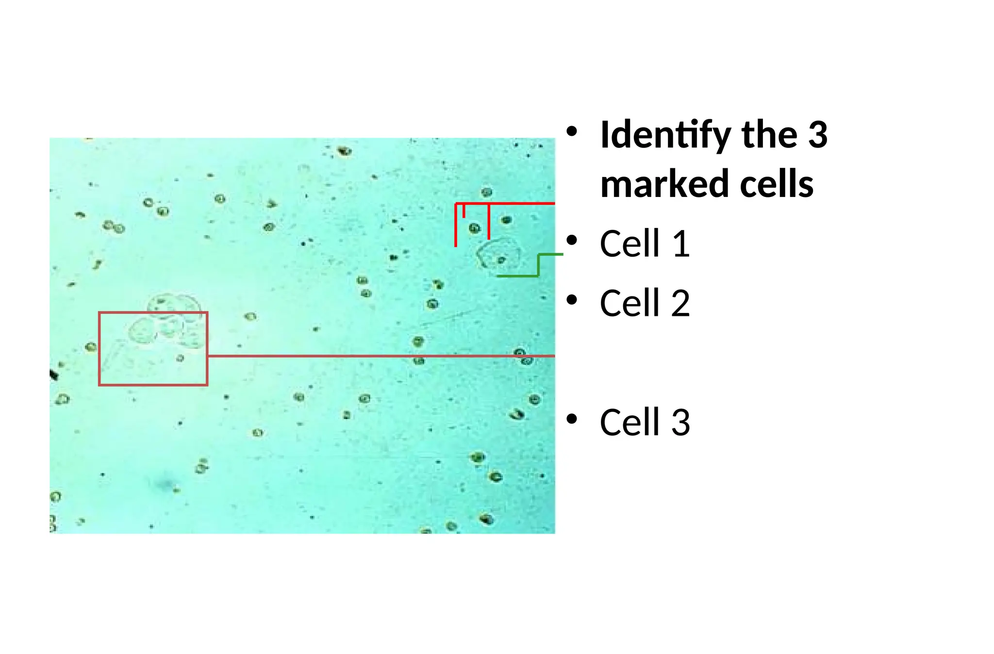 • Identify the 3
marked cells
• Cell 1
• Cell 2
• Cell 3
 