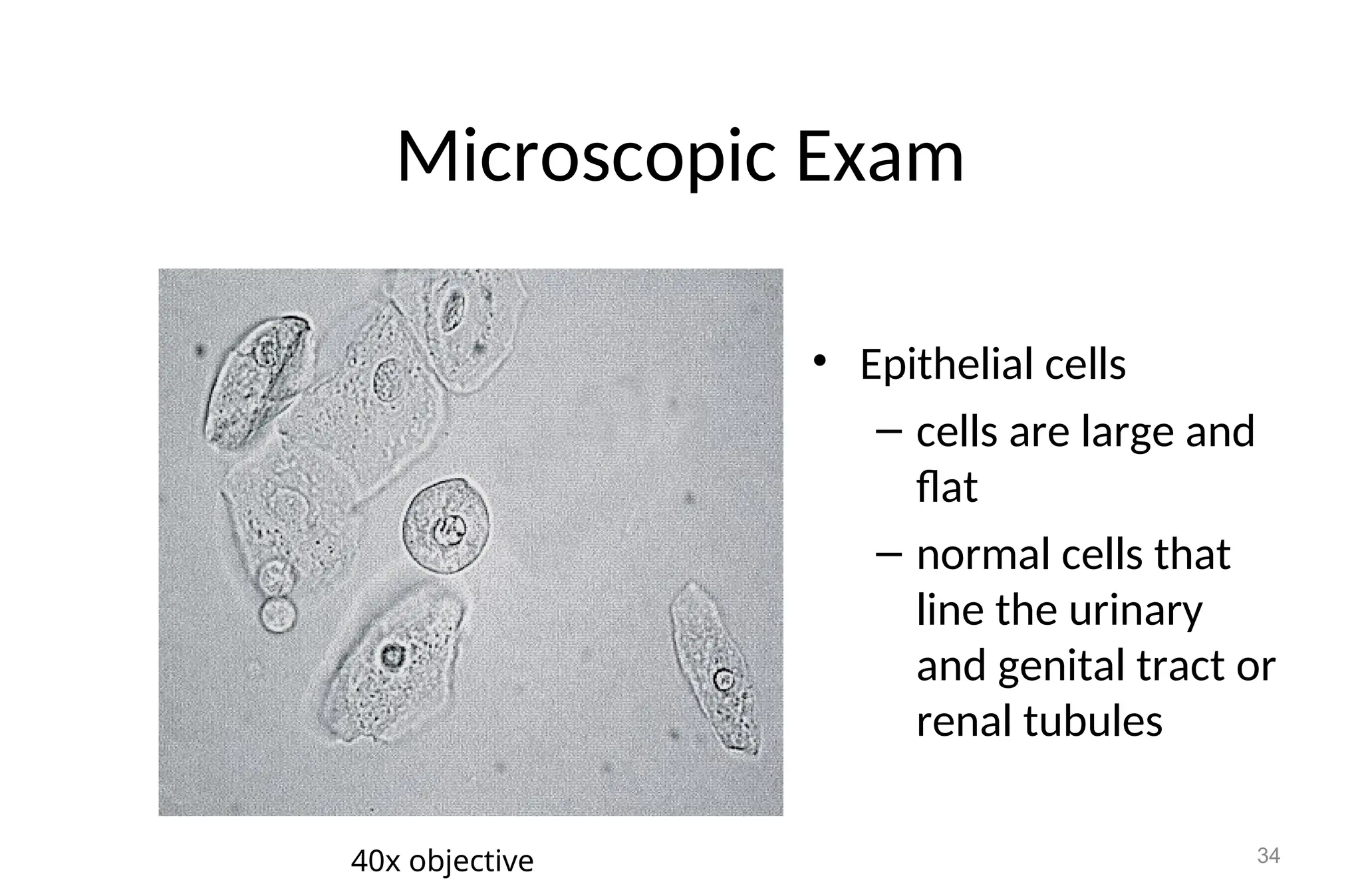 Microscopic Exam
• Epithelial cells
– cells are large and
flat
– normal cells that
line the urinary
and genital tract or
renal tubules
34
40x objective
 