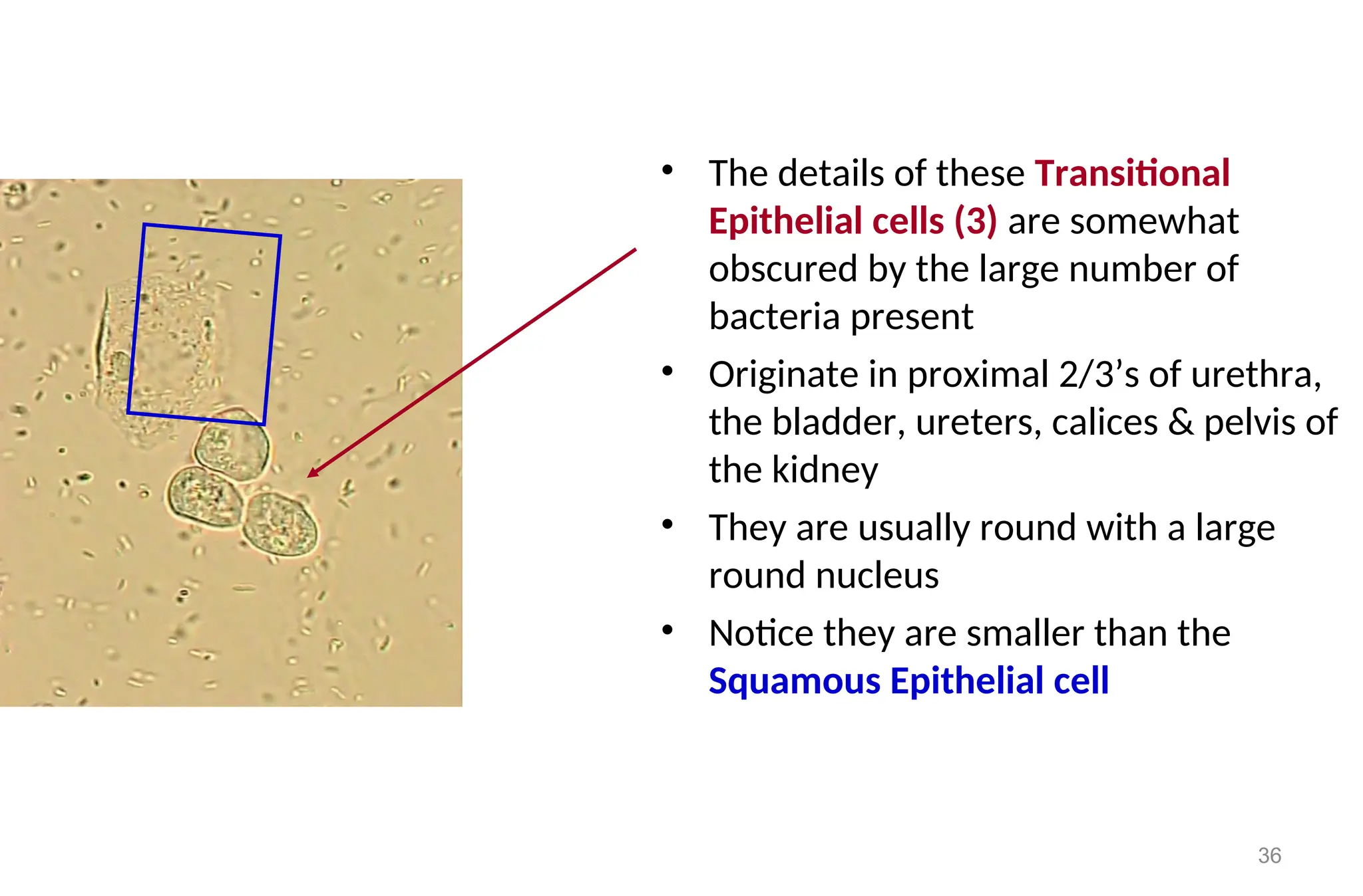 36
• The details of these Transitional
Epithelial cells (3) are somewhat
obscured by the large number of
bacteria present
• Originate in proximal 2/3’s of urethra,
the bladder, ureters, calices & pelvis of
the kidney
• They are usually round with a large
round nucleus
• Notice they are smaller than the
Squamous Epithelial cell
 