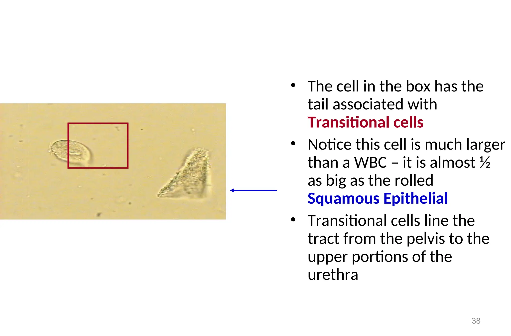 38
• The cell in the box has the
tail associated with
Transitional cells
• Notice this cell is much larger
than a WBC – it is almost ½
as big as the rolled
Squamous Epithelial
• Transitional cells line the
tract from the pelvis to the
upper portions of the
urethra
 