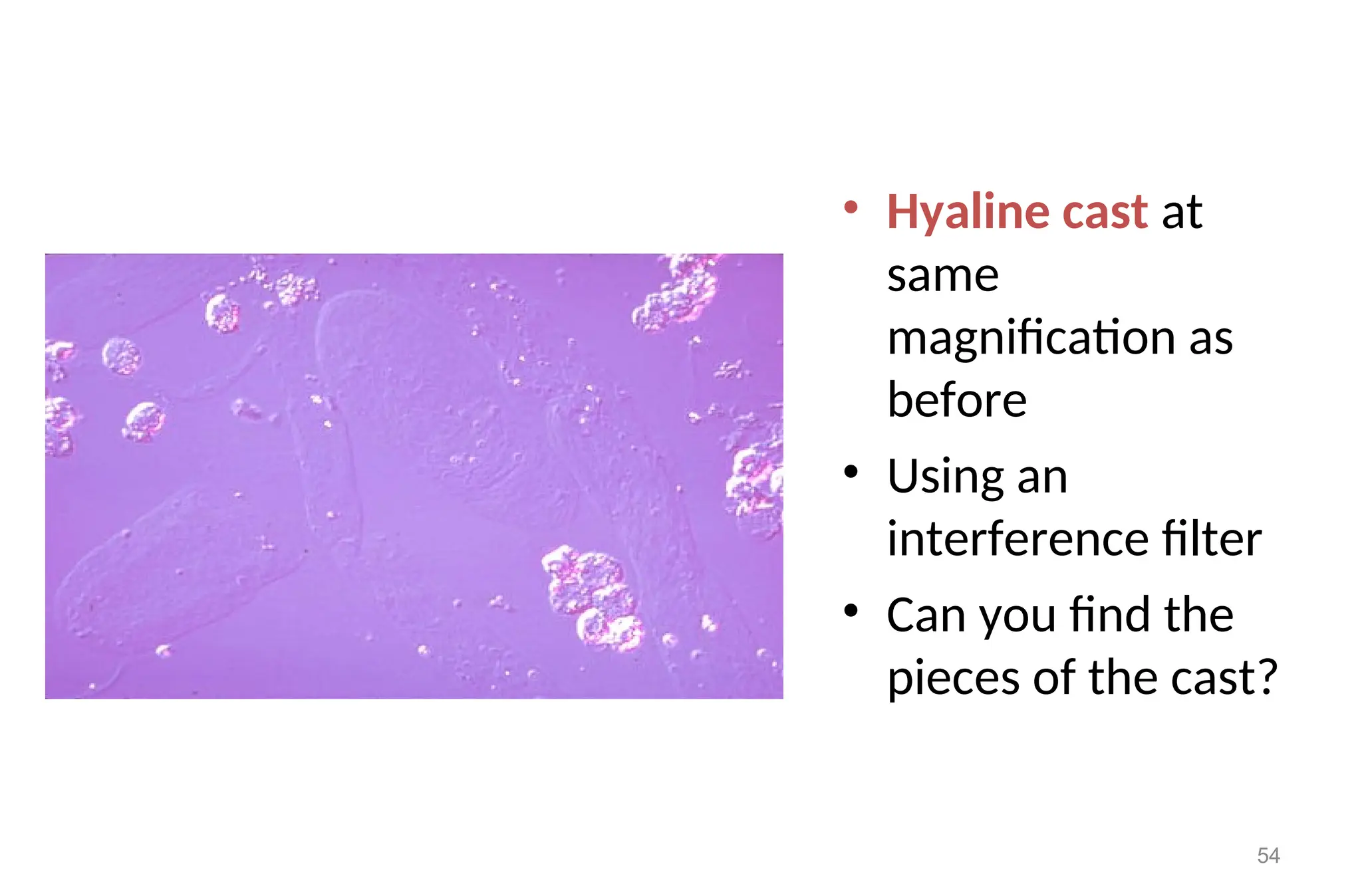 • Hyaline cast at
same
magnification as
before
• Using an
interference filter
• Can you find the
pieces of the cast?
54
 