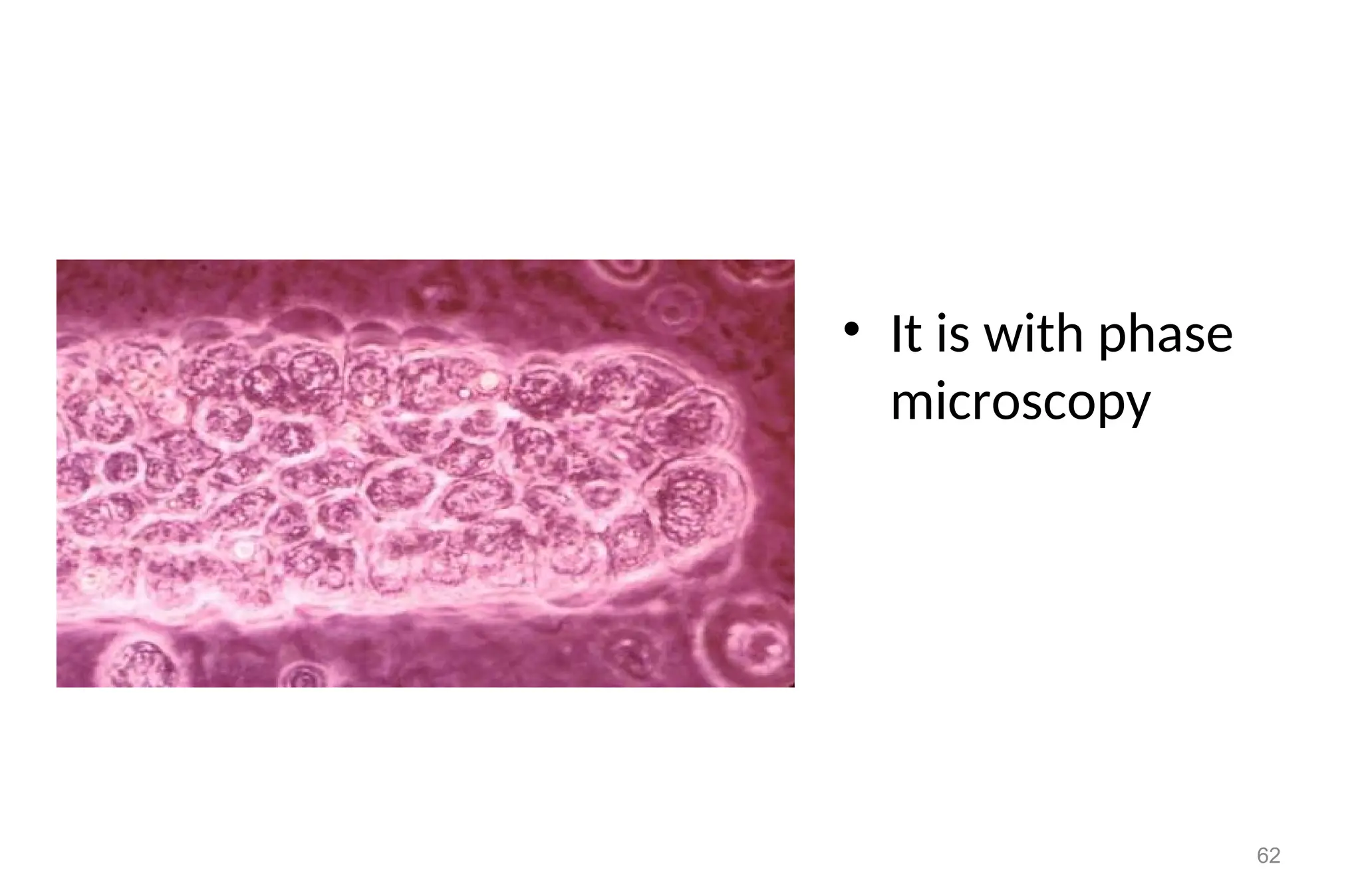 • It is with phase
microscopy
62
 