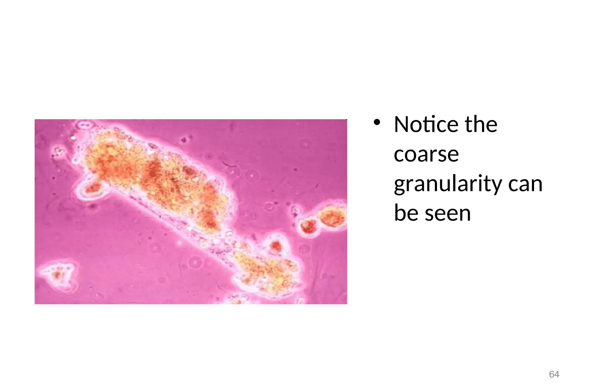 • Notice the
coarse
granularity can
be seen
64
 