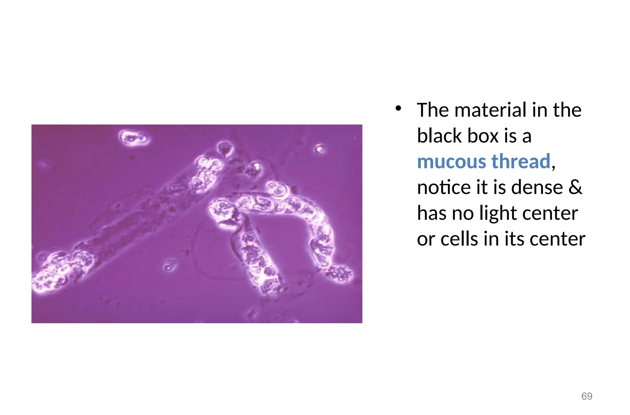 • The material in the
black box is a
mucous thread,
notice it is dense &
has no light center
or cells in its center
69
 