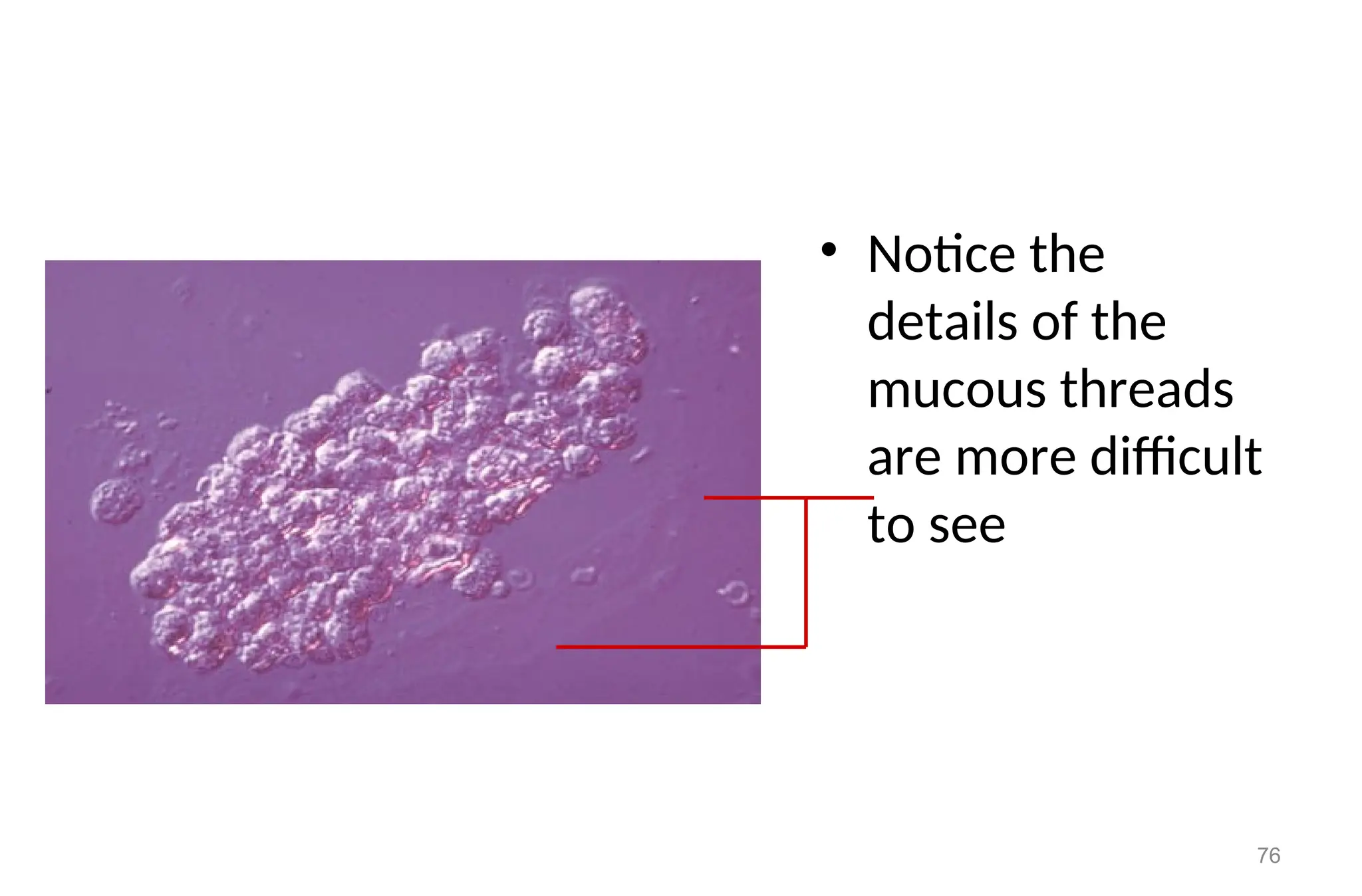 • Notice the
details of the
mucous threads
are more difficult
to see
76
 