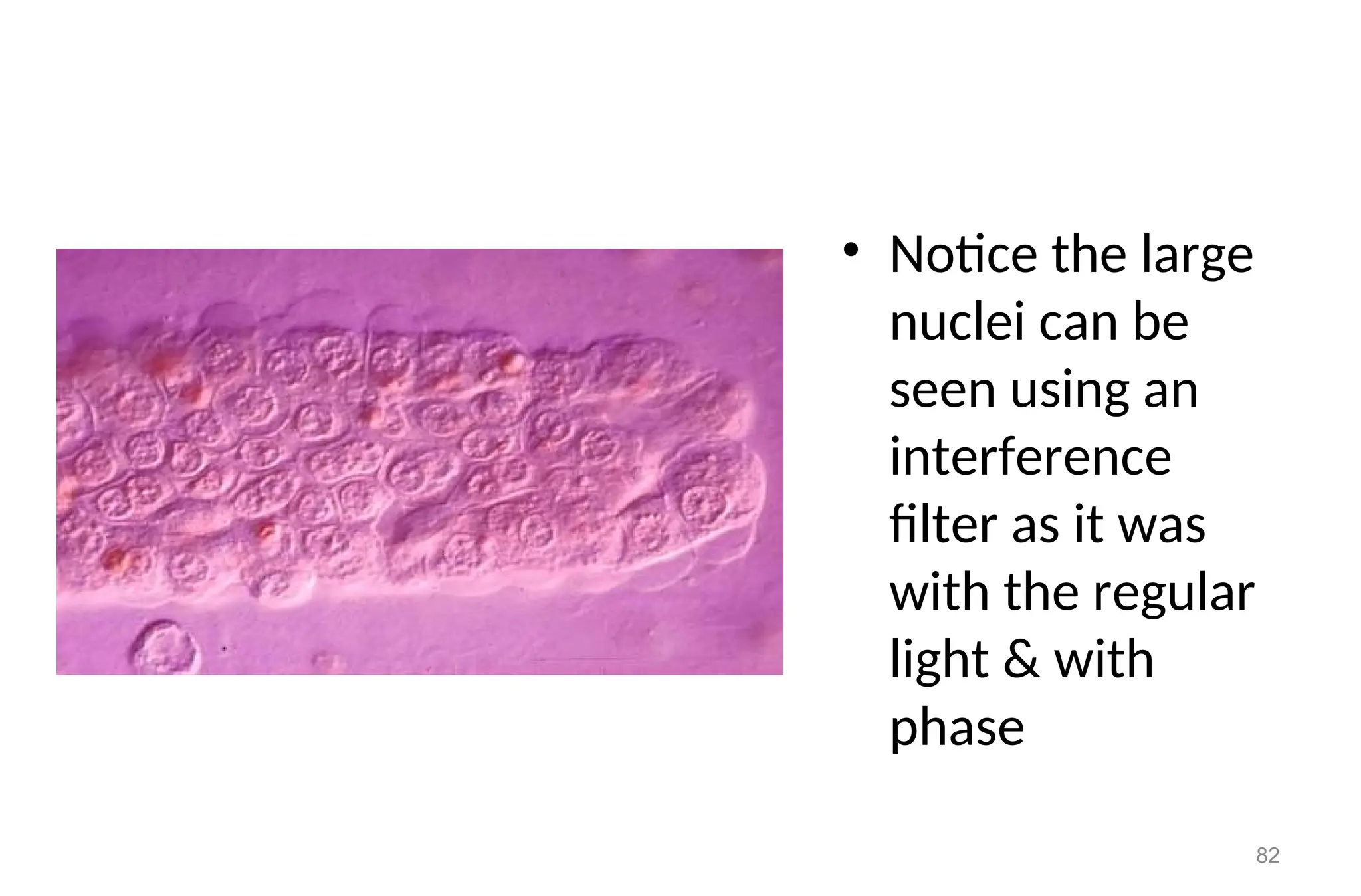 • Notice the large
nuclei can be
seen using an
interference
filter as it was
with the regular
light & with
phase
82
 