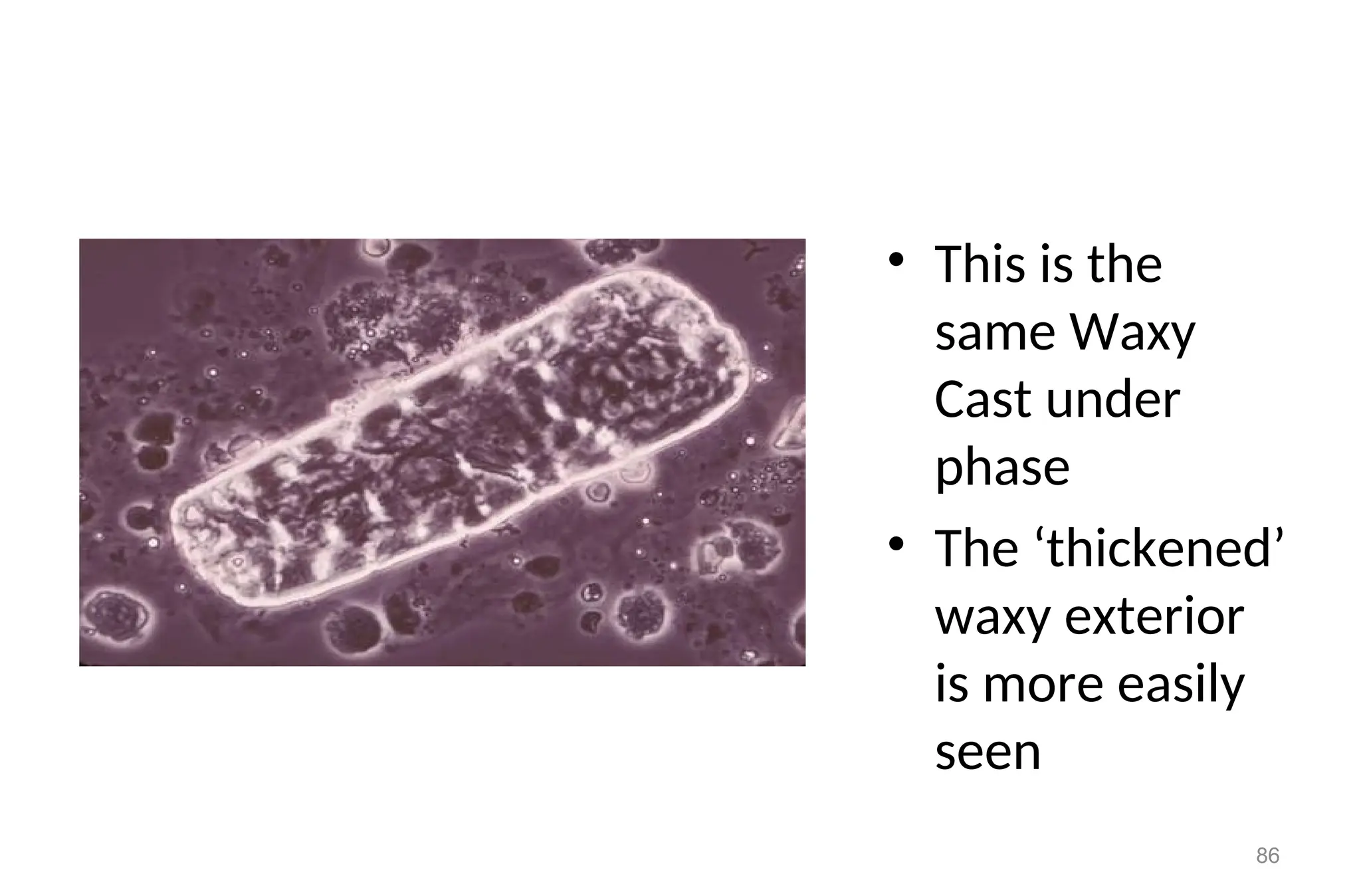 • This is the
same Waxy
Cast under
phase
• The ‘thickened’
waxy exterior
is more easily
seen
86
 