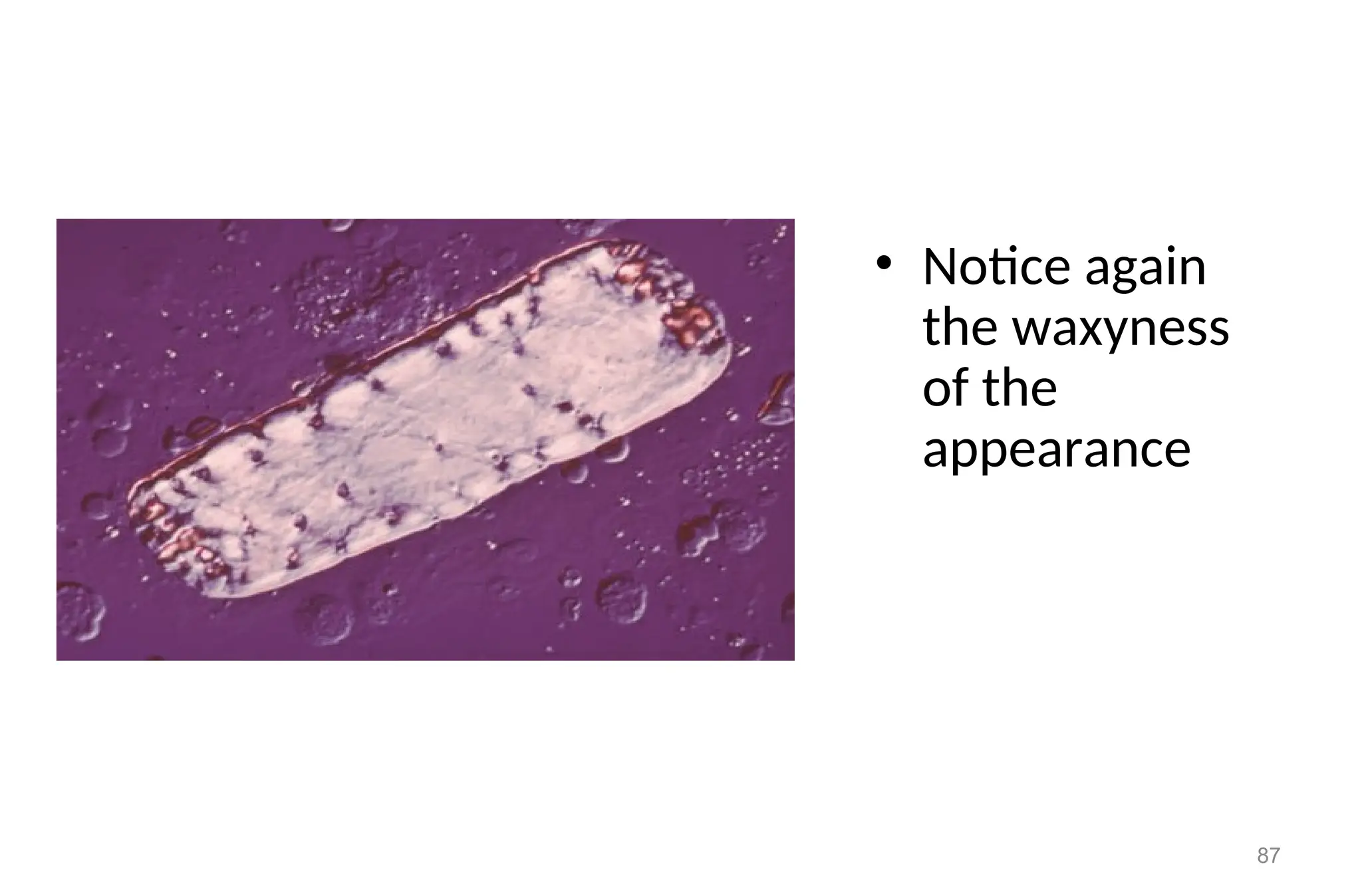• Notice again
the waxyness
of the
appearance
87
 