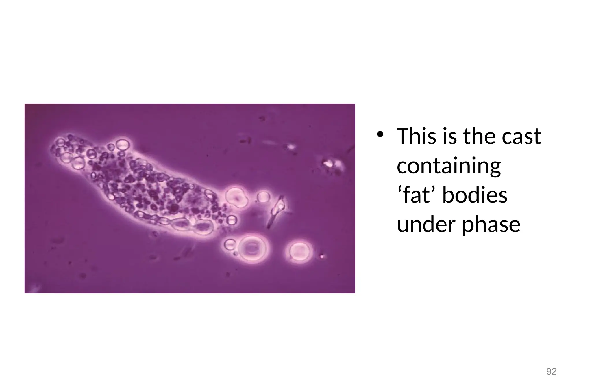 • This is the cast
containing
‘fat’ bodies
under phase
92
 