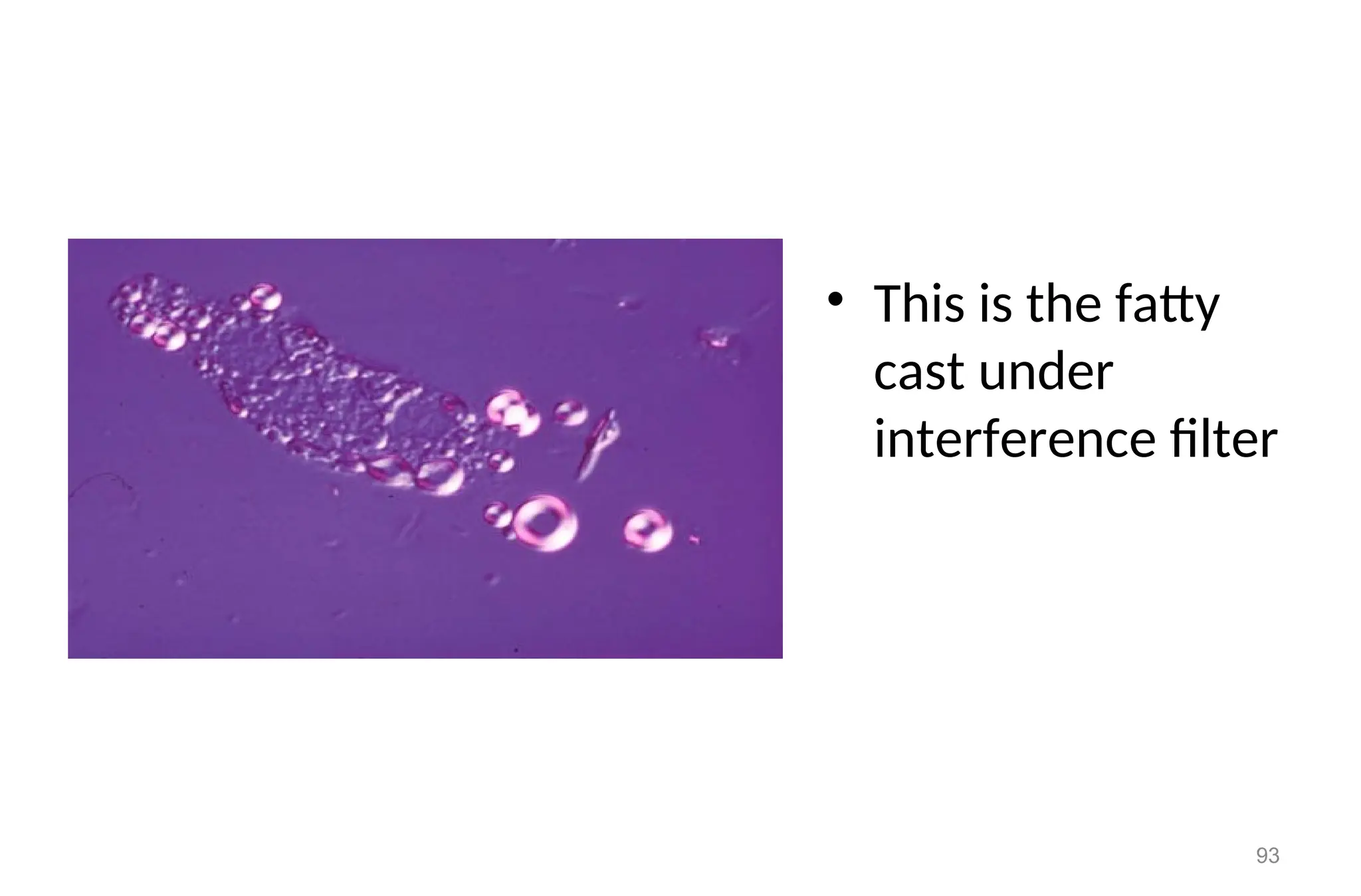 • This is the fatty
cast under
interference filter
93
 