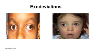 December 31, 2025
Exodeviations
 