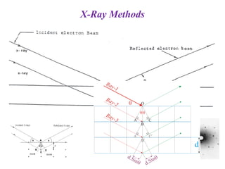 X-Ray Methods
 