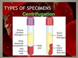 TYPES OF SPECIMENS
Centrifugation
 