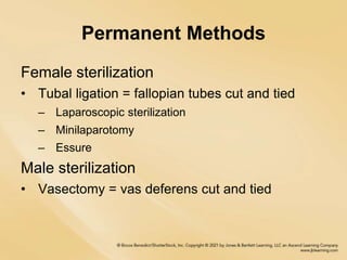 Permanent Methods
Female sterilization
• Tubal ligation = fallopian tubes cut and tied
– Laparoscopic sterilization
– Minilaparotomy
– Essure
Male sterilization
• Vasectomy = vas deferens cut and tied
 