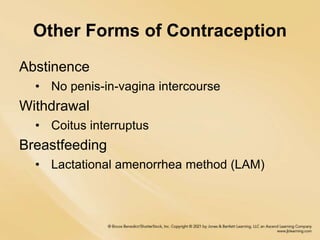 Other Forms of Contraception
Abstinence
• No penis-in-vagina intercourse
Withdrawal
• Coitus interruptus
Breastfeeding
• Lactational amenorrhea method (LAM)
 