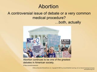 Abortion
A controversial issue of debate or a very common
medical procedure?
…both, actually
Abortion continues to be one of the greatest
debates in American society.
© Rena Schild/Shutterstock
 