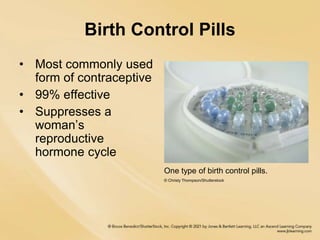 Birth Control Pills
• Most commonly used
form of contraceptive
• 99% effective
• Suppresses a
woman’s
reproductive
hormone cycle
One type of birth control pills.
© Christy Thompson/Shutterstock
 