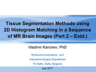 Tissue Segmentation Methods using
2D Histogram Matching in a Sequence
of MR Brain Images (Part 2 – Extd.)
Vladimir Kanchev, PhD
Radiocommunications and
Videotechnologies Department
TU Sofia, Sofia, Bulgaria
July 2017
 