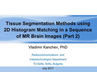Tissue Segmentation Methods using
2D Histogram Matching in a Sequence
of MR Brain Images (Part 2)
Vladimir Kanchev, PhD
Radiocommunications and
Videotechnologies Department
TU Sofia, Sofia, Bulgaria
July 2017
 