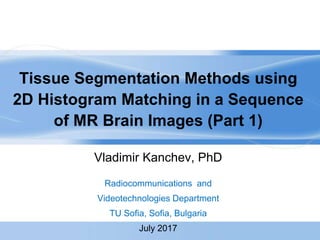 Tissue Segmentation Methods using
2D Histogram Matching in a Sequence
of MR Brain Images (Part 1)
Vladimir Kanchev, PhD
Radiocommunications and
Videotechnologies Department
TU Sofia, Sofia, Bulgaria
July 2017
 