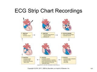 ECG Strip Chart Recordings 
•Copyright © 2014, 2011, 2006 by Saunders, an imprint of Elsevier, Inc. •107 
 