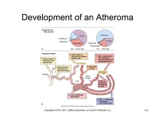 Development of an Atheroma 
•Copyright © 2014, 2011, 2006 by Saunders, an imprint of Elsevier, Inc. •127 
 