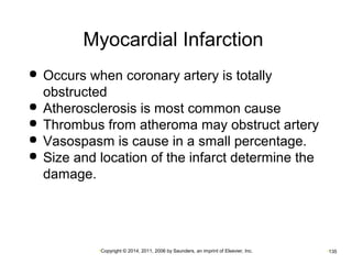 Myocardial Infarction 
 Occurs when coronary artery is totally 
obstructed 
 Atherosclerosis is most common cause 
 Thrombus from atheroma may obstruct artery 
 Vasospasm is cause in a small percentage. 
 Size and location of the infarct determine the 
damage. 
•Copyright © 2014, 2011, 2006 by Saunders, an imprint of Elsevier, Inc. •135 
 