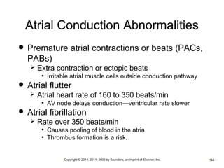 Atrial Conduction Abnormalities 
 Premature atrial contractions or beats (PACs, 
PABs) 
 Extra contraction or ectopic beats 
• Irritable atrial muscle cells outside conduction pathway 
 Atrial flutter 
 Atrial heart rate of 160 to 350 beats/min 
• AV node delays conduction—ventricular rate slower 
 Atrial fibrillation 
 Rate over 350 beats/min 
• Causes pooling of blood in the atria 
• Thrombus formation is a risk. 
•Copyright © 2014, 2011, 2006 by Saunders, an imprint of Elsevier, Inc. •144 
 