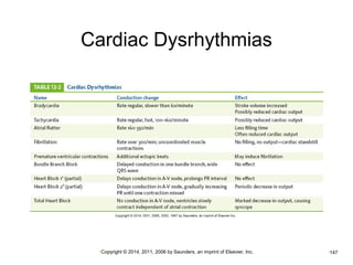 Cardiac Dysrhythmias 
•Copyright © 2014, 2011, 2006 by Saunders, an imprint of Elsevier, Inc. •147 
 