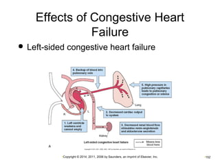 Effects of Congestive Heart 
Failure 
 Left-sided congestive heart failure 
•Copyright © 2014, 2011, 2006 by Saunders, an imprint of Elsevier, Inc. •152 
 