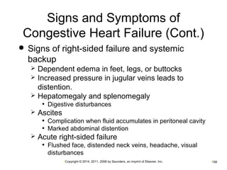 Signs and Symptoms of 
Congestive Heart Failure (Cont.) 
 Signs of right-sided failure and systemic 
backup 
 Dependent edema in feet, legs, or buttocks 
 Increased pressure in jugular veins leads to 
distention. 
 Hepatomegaly and splenomegaly 
• Digestive disturbances 
•Copyright © 2014, 2011, 2006 by Saunders, an imprint of Elsevier, Inc. •156 
 Ascites 
• Complication when fluid accumulates in peritoneal cavity 
• Marked abdominal distention 
 Acute right-sided failure 
• Flushed face, distended neck veins, headache, visual 
disturbances 
 