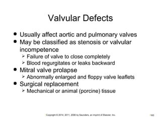 Valvular Defects 
 Usually affect aortic and pulmonary valves 
 May be classified as stenosis or valvular 
incompetence 
 Failure of valve to close completely 
 Blood regurgitates or leaks backward 
 Mitral valve prolapse 
 Abnormally enlarged and floppy valve leaflets 
 Surgical replacement 
 Mechanical or animal (porcine) tissue 
•Copyright © 2014, 2011, 2006 by Saunders, an imprint of Elsevier, Inc. •163 
 
