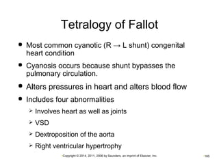 Tetralogy of Fallot 
 Most common cyanotic (R → L shunt) congenital 
heart condition 
 Cyanosis occurs because shunt bypasses the 
pulmonary circulation. 
 Alters pressures in heart and alters blood flow 
 Includes four abnormalities 
 Involves heart as well as joints 
 VSD 
 Dextroposition of the aorta 
 Right ventricular hypertrophy 
•Copyright © 2014, 2011, 2006 by Saunders, an imprint of Elsevier, Inc. •165 
 