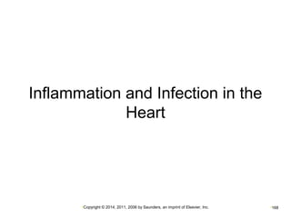 Inflammation and Infection in the 
Heart 
•Copyright © 2014, 2011, 2006 by Saunders, an imprint of Elsevier, Inc. •168 
 