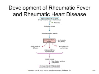 Development of Rheumatic Fever 
and Rheumatic Heart Disease 
•Copyright © 2014, 2011, 2006 by Saunders, an imprint of Elsevier, Inc. •172 
 