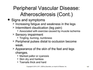 Peripheral Vascular Disease: 
Atherosclerosis (Cont.) 
 Signs and symptoms 
 Increasing fatigue and weakness in the legs 
 Intermittent claudication (leg pain) 
• Associated with exercise caused by muscle ischemia 
 Sensory impairment 
• Tingling, burning, numbness 
 Peripheral pulses distal to occlusion become 
weak. 
 Appearance of the skin of the feet and legs 
changes. 
• Marked pallor or cyanosis 
• Skin dry and hairless 
• Toenails thick and hard 
•Copyright © 2014, 2011, 2006 by Saunders, an imprint of Elsevier, Inc. •187 
 