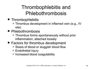 Thrombophlebitis and 
Phlebothrombosis 
 Thrombophlebitis 
 Thrombus development in inflamed vein (e.g., IV 
site) 
 Phlebothrombosis 
 Thrombus forms spontaneously without prior 
inflammation; attached loosely 
 Factors for thrombus development 
 Stasis of blood or sluggish blood flow 
 Endothelial injury 
 Increased blood coagulability 
•Copyright © 2014, 2011, 2006 by Saunders, an imprint of Elsevier, Inc. •196 
 