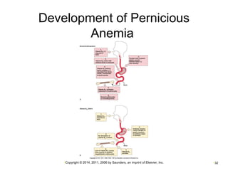 Development of Pernicious 
Anemia 
•Copyright © 2014, 2011, 2006 by Saunders, an imprint of Elsevier, Inc. •32 
 