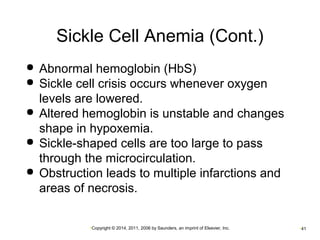 Sickle Cell Anemia (Cont.) 
 Abnormal hemoglobin (HbS) 
 Sickle cell crisis occurs whenever oxygen 
levels are lowered. 
 Altered hemoglobin is unstable and changes 
shape in hypoxemia. 
 Sickle-shaped cells are too large to pass 
through the microcirculation. 
 Obstruction leads to multiple infarctions and 
areas of necrosis. 
•Copyright © 2014, 2011, 2006 by Saunders, an imprint of Elsevier, Inc. •41 
 