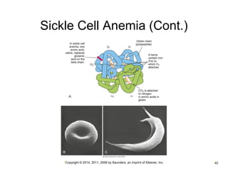 Sickle Cell Anemia (Cont.) 
•Copyright © 2014, 2011, 2006 by Saunders, an imprint of Elsevier, Inc. •42 
 