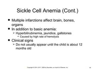 Sickle Cell Anemia (Cont.) 
 Multiple infarctions affect brain, bones, 
organs 
 In addition to basic anemia: 
 Hyperbilirubinemia, jaundice, gallstones 
• Caused by high rate of hemolysis 
 Clinical signs 
 Do not usually appear until the child is about 12 
months old 
•Copyright © 2014, 2011, 2006 by Saunders, an imprint of Elsevier, Inc. •44 
 