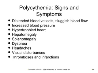 Polycythemia: Signs and 
Symptoms 
 Distended blood vessels, sluggish blood flow 
 Increased blood pressure 
 Hypertrophied heart 
 Hepatomegaly 
 Splenomegaly 
 Dyspnea 
 Headaches 
 Visual disturbances 
 Thromboses and infarctions 
•Copyright © 2014, 2011, 2006 by Saunders, an imprint of Elsevier, Inc. •49 
 