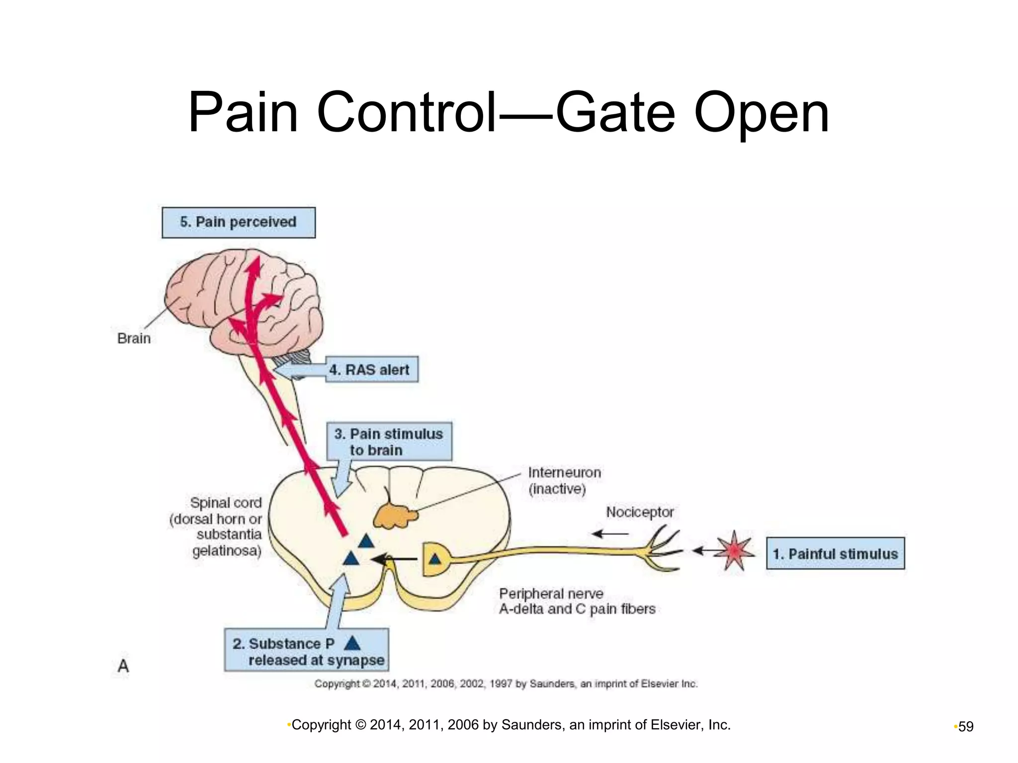Pain Control―Gate Open 
•Copyright © 2014, 2011, 2006 by Saunders, an imprint of Elsevier, Inc. •59 
 