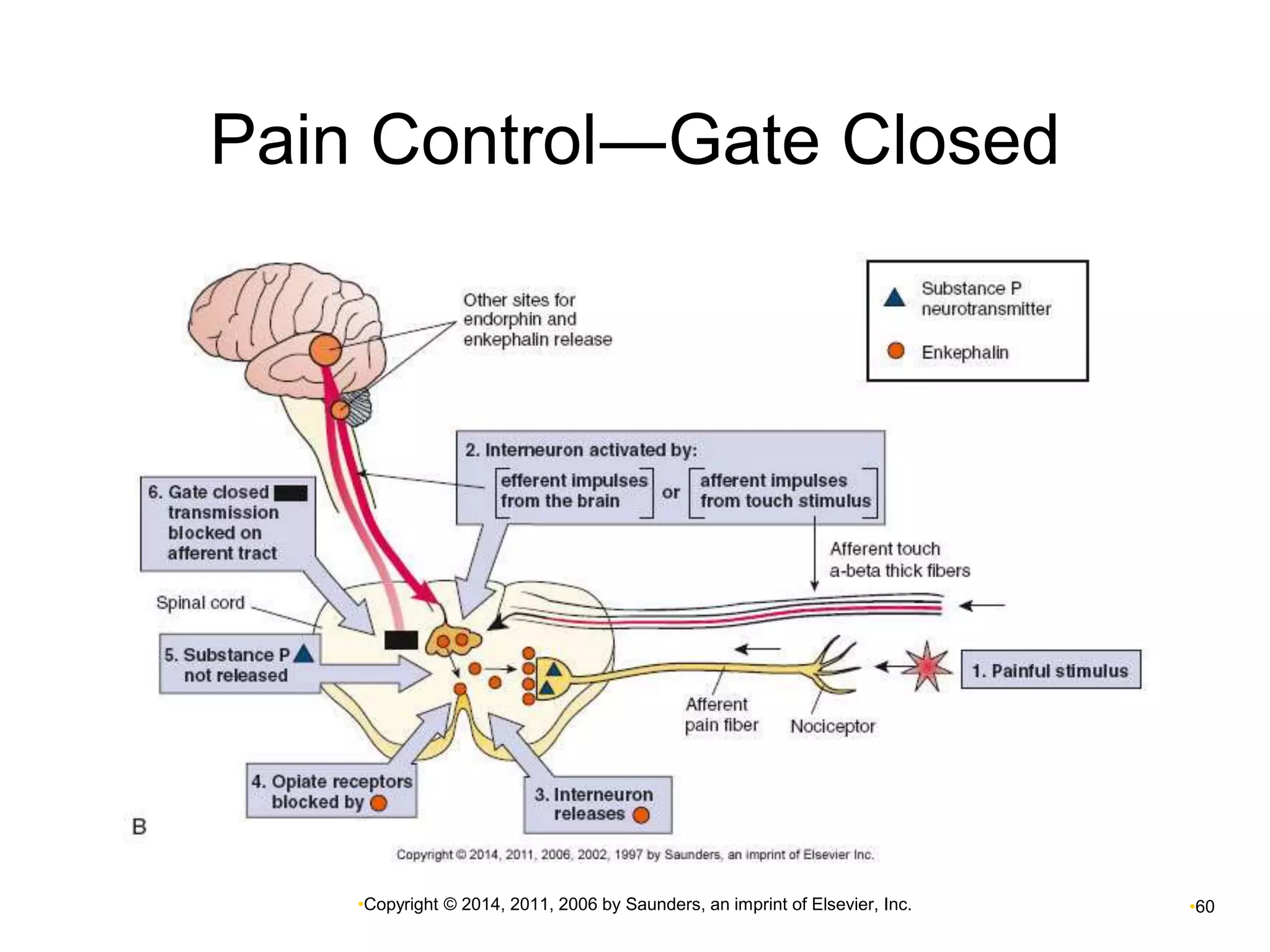 Pain Control―Gate Closed 
•Copyright © 2014, 2011, 2006 by Saunders, an imprint of Elsevier, Inc. •60 
 