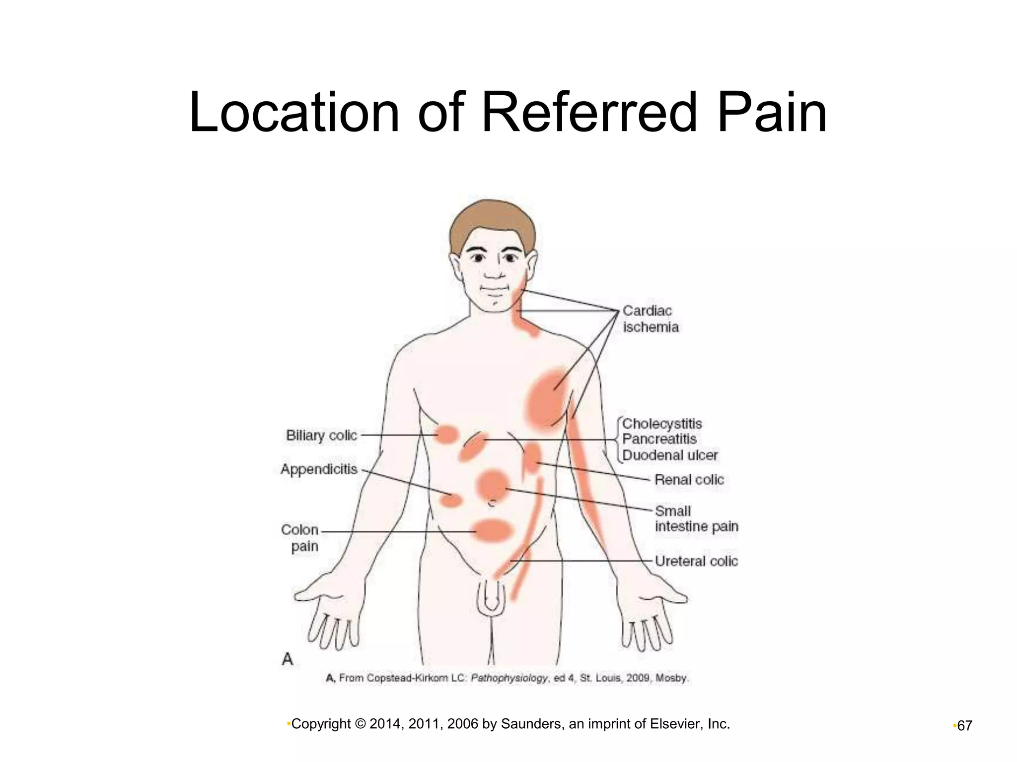 Location of Referred Pain 
•Copyright © 2014, 2011, 2006 by Saunders, an imprint of Elsevier, Inc. •67 
 