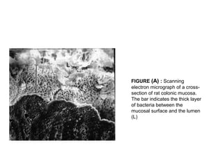 FIGURE (A) : Scanning
electron micrograph of a cross-
section of rat colonic mucosa.
The bar indicates the thick layer
of bacteria between the
mucosal surface and the lumen
(L)
 