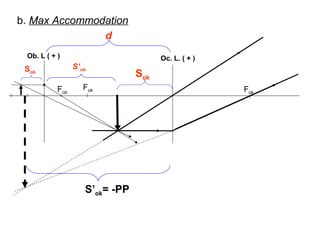 b. Max Accommodation
Fob Fok
Oc. L. ( + )Ob. L ( + )
S’ok= -PP
Sok
Sob
S’ob
Fok
d
 