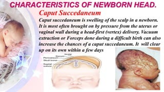 Characteristic of newborn and reflexes | PPTX