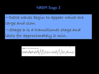 NREM Stage 3

~Delta waves begin to appear which are
large and slow.
~Stage 3 is a transitional stage and
lasts for approximately 2 min.
 