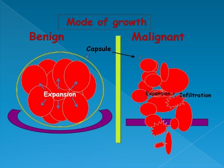 What are malignant tumors?